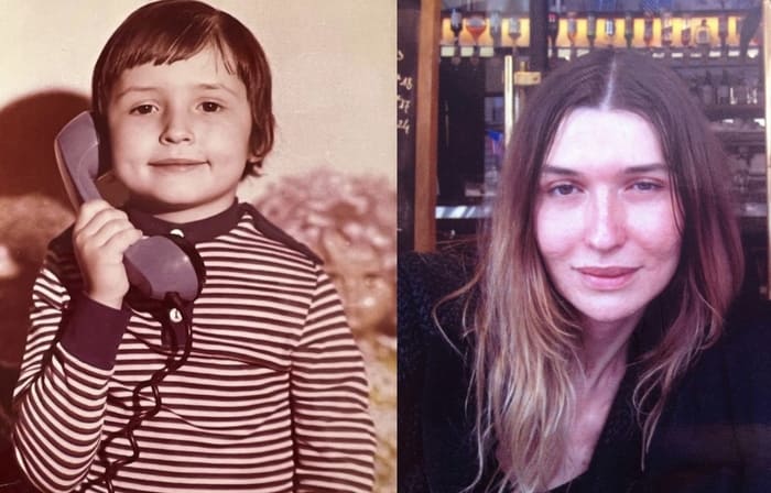 Наталья Максимова до и после операции